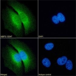 LRPAP Rabbit anti-Human, Clone: 7F1, Novus Biologicals 0.2 mg; Unconjugated:Antibodies,